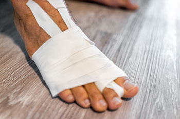Broken foot and ankle treatment in the Broward County, FL: Tamarac (Margate, Palm Aire, Coral Springs, Parkland, Coconut Creek, Sunrise, Lauderdale Lakes, Plantation, Lauderhill, Oakland Park, Wilton Manors, Pompano Beach, Hollywood, West Park, Miramar, Hallandale Beach) and Miami-Dade County, FL: North Miami Beach (Opa-locka, Westview, Palm Springs North, Miami Lakes, Miami Gardens, Aventura) and Miami (Fisher Island, Miami Beach, Coral Gables, Westchester, Hialeah, Key Biscayne, Fontainebleau) areas